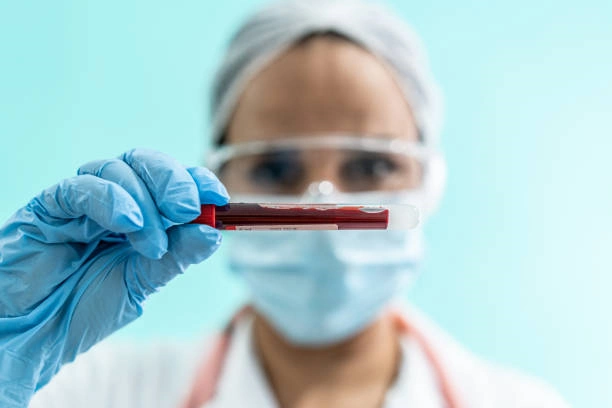 Exames laboratoriais check up