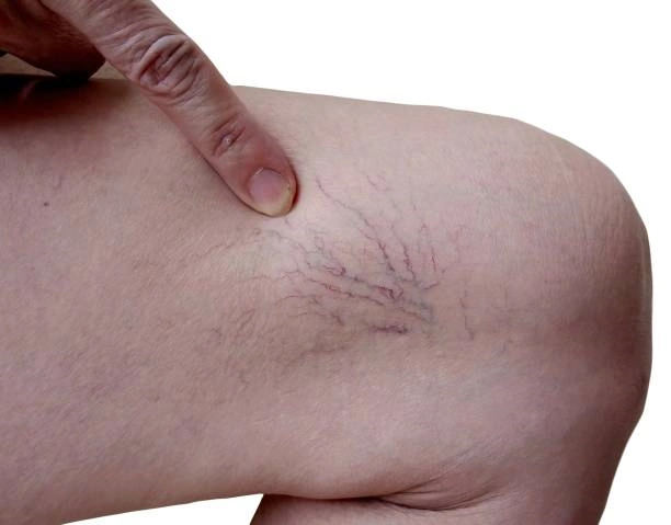 Medico vascular em Cotia