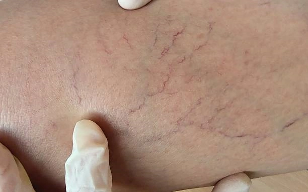 Medico vascular em Vargem Grande Paulista